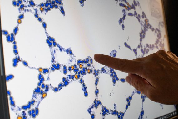Dr. Amanda Martinot, Assistant Professor of Infectious Diseases at Cummings School of Veterinary Medicine at Tufts University, shows a detail of cell structures from data gathered in her lab on October 26, 2020. (Alonso Nichols/Tufts University)